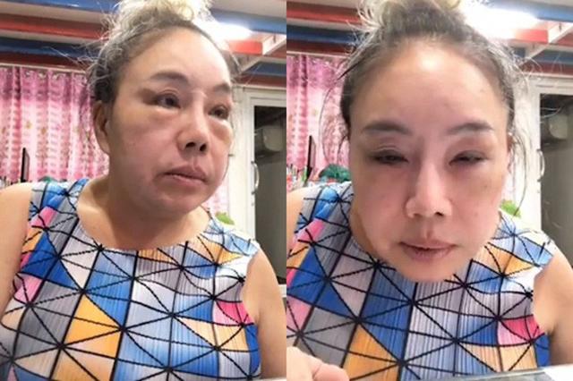 su that nhan sac nhu gai 20 cua nu dai gia tuyen chong "yeu" 28 lan/ngay sau tham my - 4