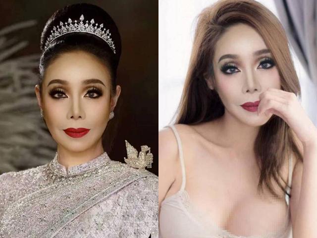 su that nhan sac nhu gai 20 cua nu dai gia tuyen chong "yeu" 28 lan/ngay sau tham my - 2