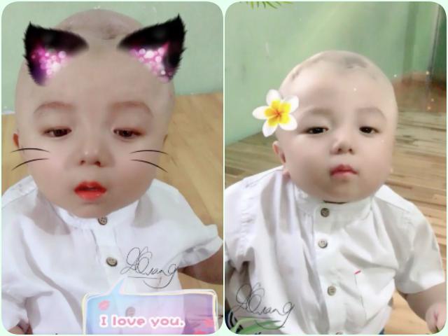 Hé lộ hình ảnh mới của bé Đức Lộc bị não úng thuỷ: Bụ bẫm, đẹp trai chuẩn soái ca