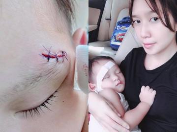 Vợ Lý Hải xót xa khi con bị ngã rách đầu, dân mạng thấy điểm sai sai trong bức ảnh