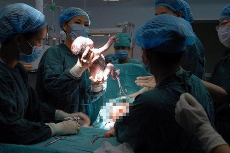 9 giờ 16 phút, bác sĩ đưa em bé đầu tiên chào đời. 

