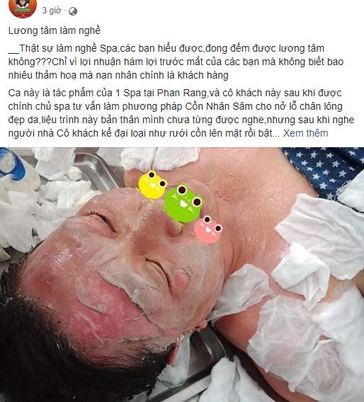 soc: co gai tuoi con bat lua xong da bi luoc chin mat, da troc thanh mang kho cuu van - 1