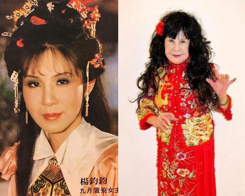Dương Quân Quân - Nữ diễn viên nổi tiếng Đài Loan những năm 50, 60 là nhân vật đầu tiên được nhắc tới. Được biết, gương mặt phù nề cùng lớp da chảy xệ của bà là hậu quả sau nhiều lần tiêm botox trẻ hoả làn da.
