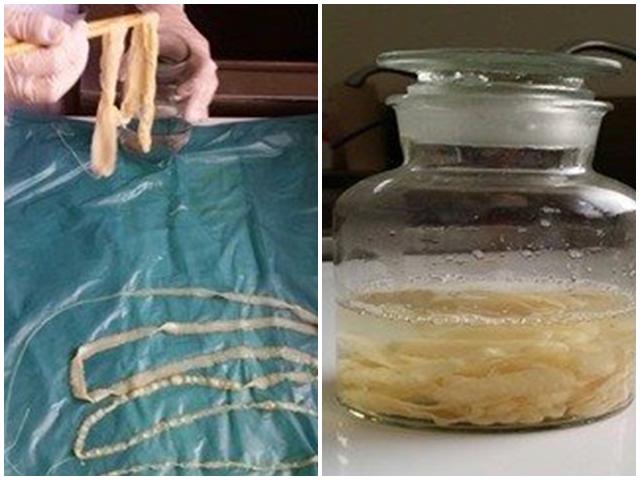 Hãi hùng hơn 100 người nhiễm sán dây lợn: cảnh báo kiểu ăn uống khiến cả búi sán làm tổ