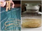 Sức khỏe - Hãi hùng hơn 100 người nhiễm sán dây lợn: cảnh báo kiểu ăn uống khiến cả búi sán làm tổ