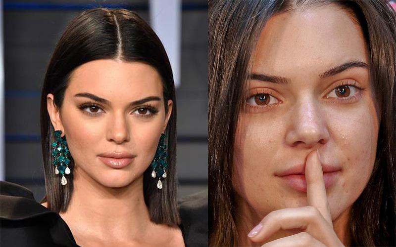 Kendall Jenner có làn da thỉnh thoảng nổi mụn, nhưng bù lại thì nét mặt cô vẫn rất hoàn hảo kể cả khi không make-up.
