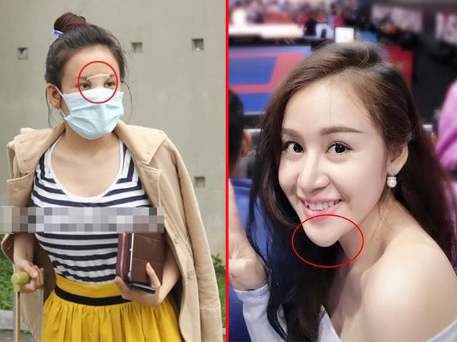 Suýt không nhận ra Bà Tưng ngày nào, dung mạo biến dạng đến mức khiến fan giật mình!