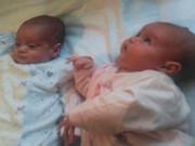 Tin tức - Hai bé từng gây sửng sốt vì sinh đôi nhưng lại chào đời cách nhau... 87 ngày giờ ra sao?