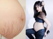 Làm đẹp - Diệp Lâm Anh sau hai tuần sinh nở đã ung dung tái xuất, khoe cách trị rạn da vùng bụng