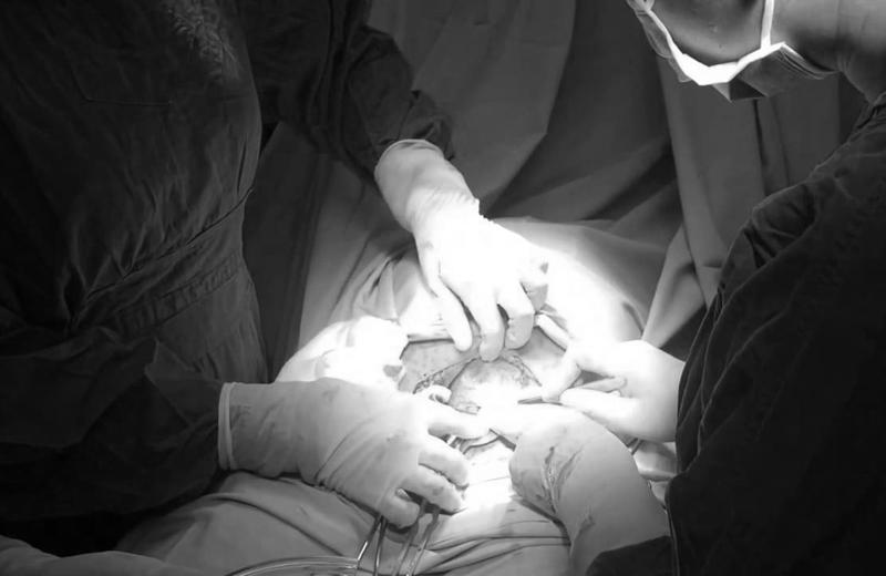 Trong quá trình mổ, đầu em bé có thể nằm sát vào thành tử cung của mẹ nên nếu bác sĩ không cẩn trọng, việc rạch trúng đầu bé có thể xảy ra. 
