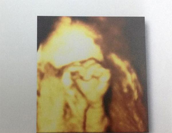 Đi siêu âm 20 tuần, mẹ Bắc Ninh amp;#34;tròn mắtamp;#34; kinh ngạc khi nhìn lên màn hình - 7