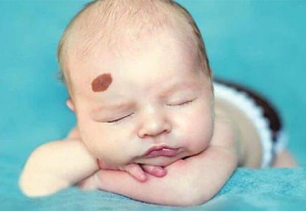 3 việc mẹ bầu nhớ tránh xa kẻo con sinh ra mang vết bớt chàm xấu xí - 1