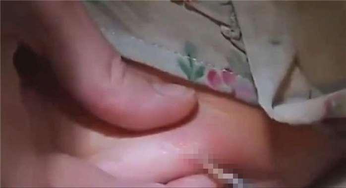 Gửi con về bà nội 1 tháng mẹ sững người khi đón lên nặn ở lưng con giòi sống 2cm - 2