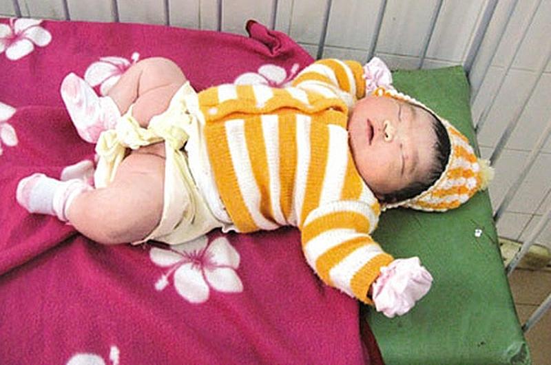 Ngày 9/10/2008, chị Hà Thị Nga (xã Ia Ly, huyện Chư Păh, tỉnh Gia Lai đã sinh mổ ở Bệnh viện Đa khoa Gia Lai một bé gái có cân nặng gần 7kg.
