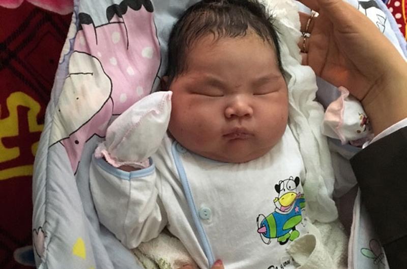 Ngày 25/2/2016, một bé trai sơ sinh có cân nặng kỷ lục 6,1kg được sinh ra ở Bệnh viện Đa khoa Công an tỉnh Nam Định khiến nhiều người bất ngờ.
