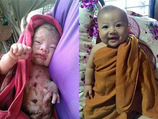 Bé trai sơ sinh bị mẹ đẻ đâm 14 nhát dao rồi chôn sống giờ ra sao?