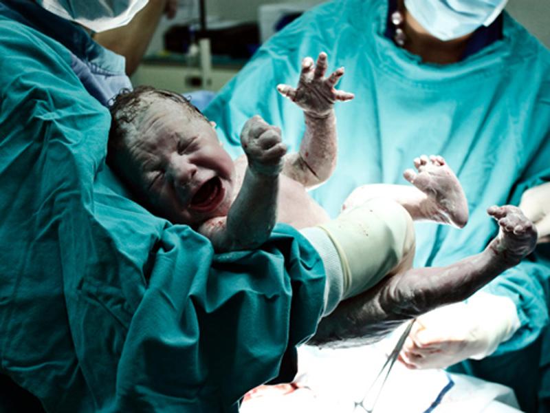 Vụ việc bác sĩ mổ đẻ nhưng em bé chào đời bằng phương pháp sinh thường được truyền thông đưa tin cách đây không lâu đã gây xôn xao dư luận toàn thế giới.
