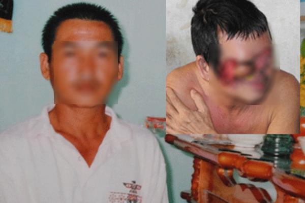 bien dang kinh khung ca khuon mat vi tay not ruoi sai cach, chi em nen canh giac cao do - 4