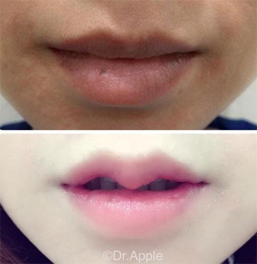 moi teu la xua qua xua roi, chi em bay gio do xo tu sua moi thanh hinh... sung trau - 5