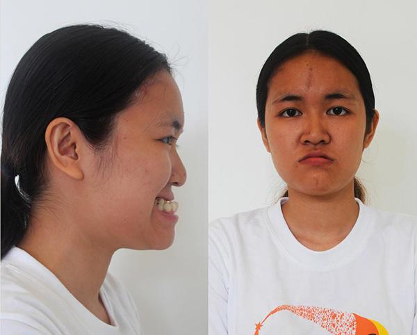 ngo ngang truoc nhung ca "dap di xay lai" ki dieu chang thua kem phuong thi no - 8