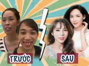 Làm đẹp - Ngỡ ngàng trước những ca "đập đi xây lại" kì diệu chẳng thua kém Phượng Thị Nở
