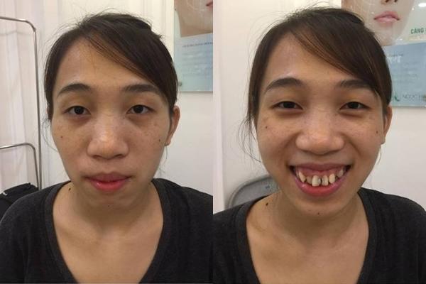 ngo ngang truoc nhung ca "dap di xay lai" ki dieu chang thua kem phuong thi no - 5