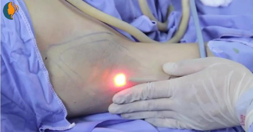 Chấm dứt chuyện hôi nách “muôn thuở” chốn văn phòng - 3