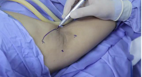 Chấm dứt chuyện hôi nách “muôn thuở” chốn văn phòng - 2