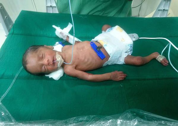 khong the mang bau sau 3 lan pha thai, co gai sinh con bang cach khong the ngo - 3