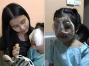 Sức khỏe - Hành động sai lầm của cha khi cho con ăn cơm khiến bé gái 4 tuổi phải phẫu thuật mắt