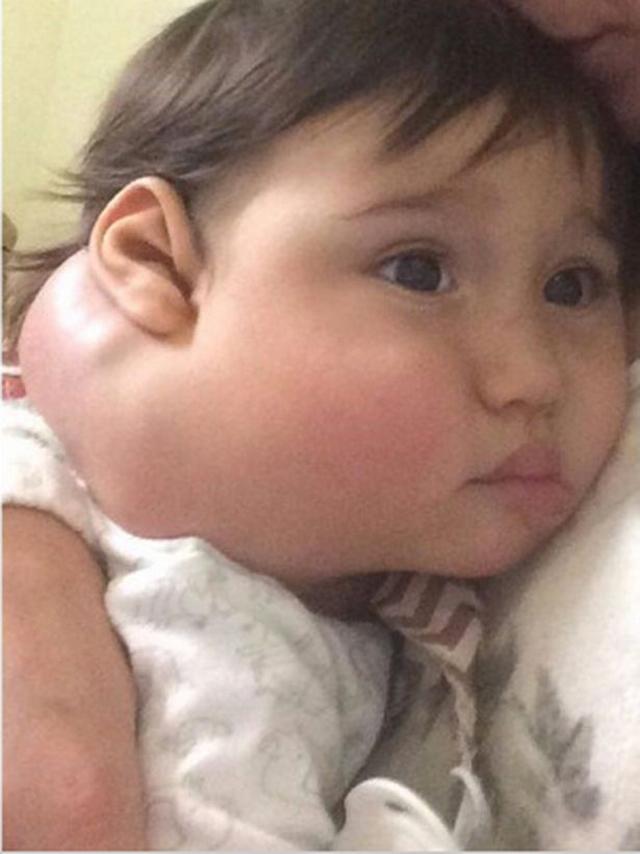 thay cuc thit nho duoi tai con, me tuong vet bot nhung lai la nguy hiem chet nguoi - 2