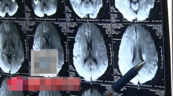 co gai suyt mat mang vi thoi quen moi toi, nhieu nguoi phai lo so vi thuong lam giong co - 2