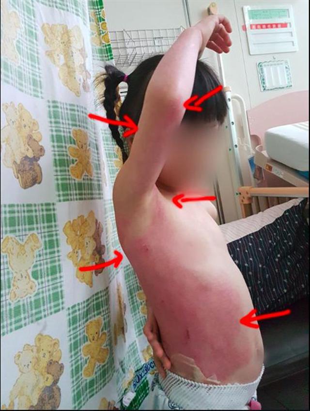 thay con gai 5 tuoi bi bong nang, bo me chet dung khi kiem tra camera truong mau giao - 2