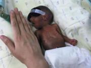 Làm mẹ - Bé sinh non 24 tuần 550gr, hình ảnh sau 5 tháng nuôi gây “ngã ngửa” vì trở thành mũm mĩm