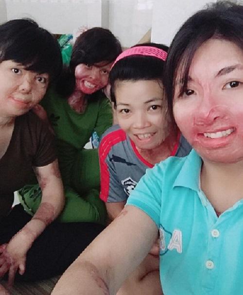 cuoc song moi cua me 9x tung bi chong tam xang dot, hon 2 nam chua dam nhin mat con - 3