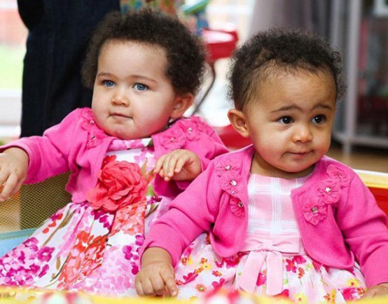 Sinh đôi khác màu da là hiện tượng hiếm gặp trên thế giới với tỉ lệ khoảng 1/10.000.000. Đây là Amelia và Jasmine, cặp song sinh cùng trứng khác màu da đầu tiên được sinh ra tại Anh. 
