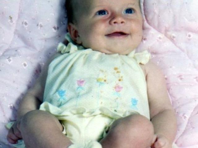 Bé gái 3 tháng tuổi bị gấu mèo ăn mất nửa khuôn mặt giờ ra sao? - 1