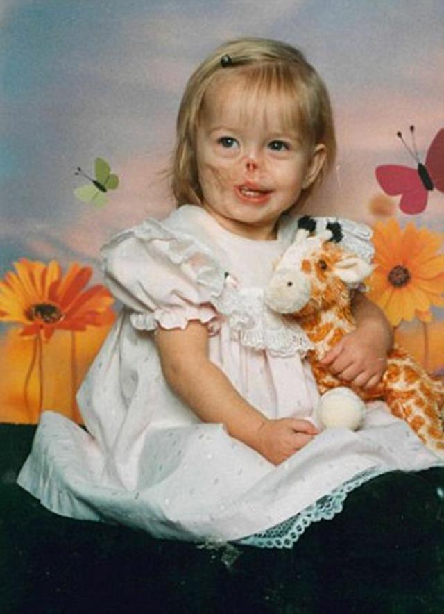 Bé gái 3 tháng tuổi bị gấu mèo ăn mất nửa khuôn mặt giờ ra sao? - 2