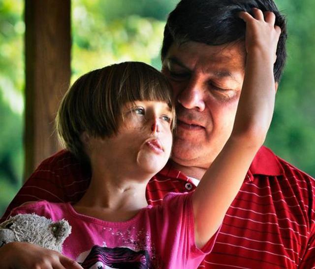 Bé gái 3 tháng tuổi bị gấu mèo ăn mất nửa khuôn mặt giờ ra sao? - 4