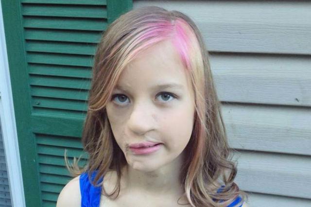 Bé gái 3 tháng tuổi bị gấu mèo ăn mất nửa khuôn mặt giờ ra sao? - 8