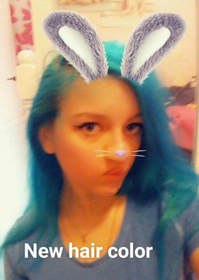 Bé gái 3 tháng tuổi bị gấu mèo ăn mất nửa khuôn mặt giờ ra sao? - 9