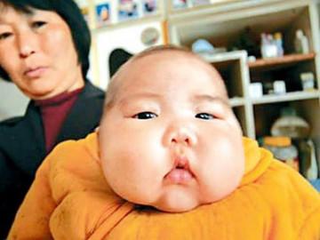 Cháu béo rụt cổ bà vẫn hãnh diện vì mát tay, bác sĩ thảng thốt bệnh ở mức nghiêm trọng