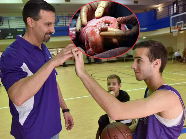 Thai nhi thò tay qua bụng nắm tay bác sĩ khiến thế giới run rẩy, giờ vẫn gây kinh ngạc