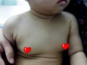 Làm mẹ - Con trai 12 tuổi ngực to như quả cam, bác sĩ: "Bị nữ tính hoá vì sai lầm của mẹ"