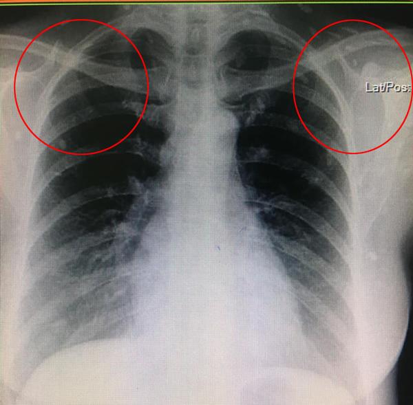 anh x-quang toan dom trang, ly giai cua bs khien nhieu nguoi nghe xong phai bo kieu an nay - 2