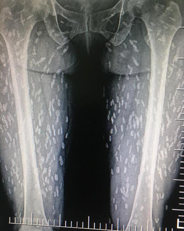 anh x-quang toan dom trang, ly giai cua bs khien nhieu nguoi nghe xong phai bo kieu an nay - 3