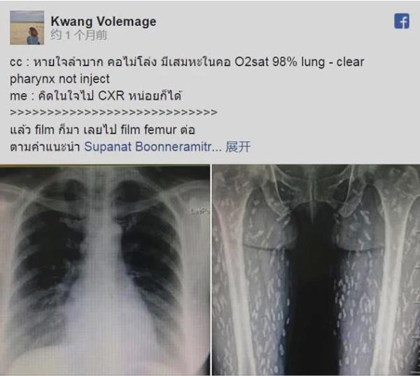 anh x-quang toan dom trang, ly giai cua bs khien nhieu nguoi nghe xong phai bo kieu an nay - 1