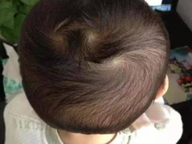 nhin xoay toc cua tre so sinh biet van menh tuong lai, kieu thu 6 thong minh bam sinh - 4