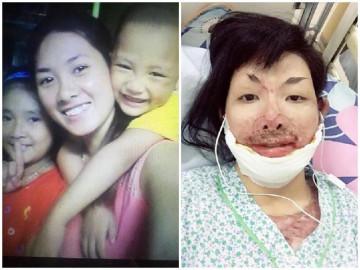 Cuộc sống mới của mẹ 9X từng bị chồng tẩm xăng đốt, hơn 2 năm chưa dám nhìn mặt con