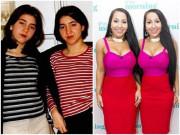 Làm đẹp - Cái giá cay đắng cho hai chị em phẫu thuật giống... búp bê tình dục để "trói" 1 anh chàng!